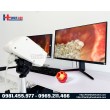 MÁY SOI CỔ TỬ CUNG MỚI NHẤT