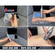 Máy siêu âm trị liệu đơn tần TEXUA