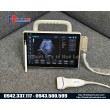 Máy siêu âm xách tay Doppler màu P10