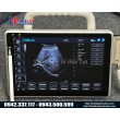 Máy siêu âm xách tay Doppler màu P10
