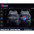 Máy Siêu Âm Hình Ảnh Cầm Tay Nano C5 EXP EDAN