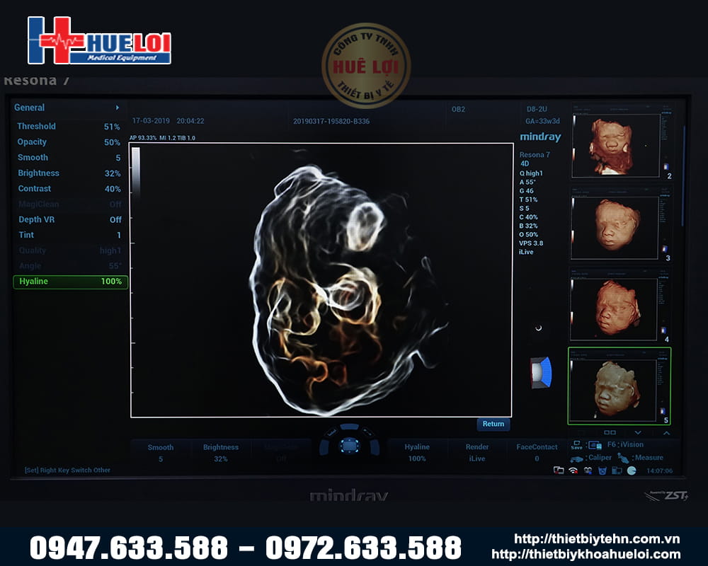 màn hình chính của mindray resona 7