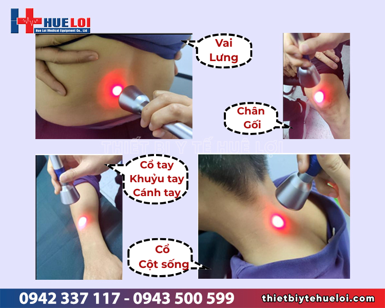 ứng dụng của sóng laser