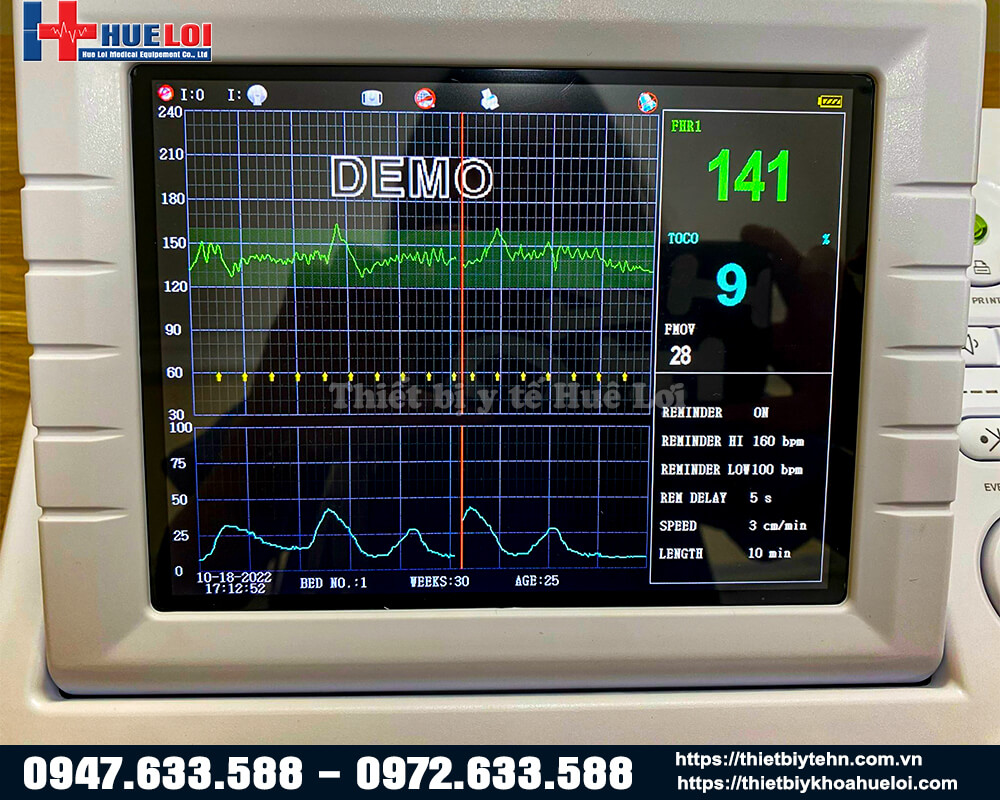 monitor sản khoa giá rẻ 