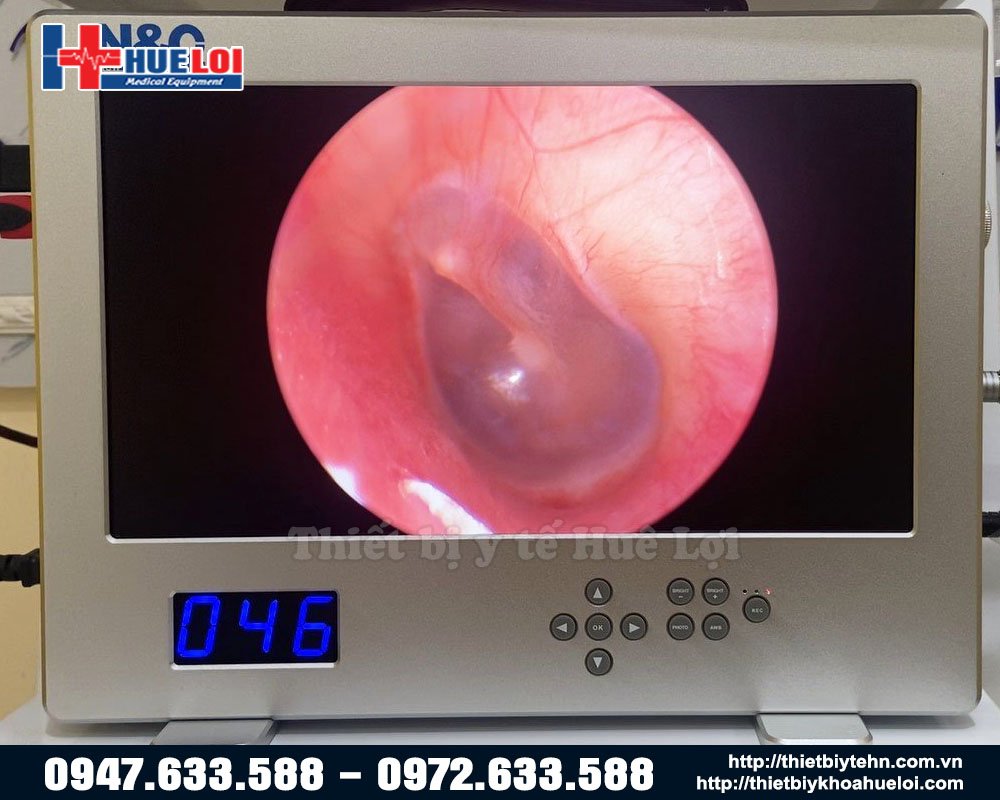 hình ảnh máy nội soi tai mũi họng NCM-15