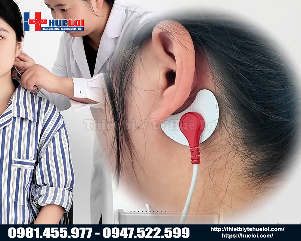 m&aacute;y từ trường xuy&ecirc;n sọ điều trị mất ngủ hiệu quả