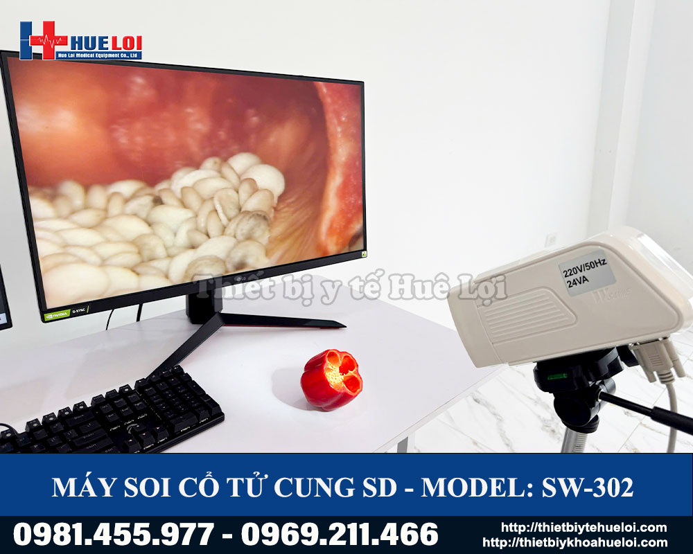m&aacute;y soi cổ tử cung HD