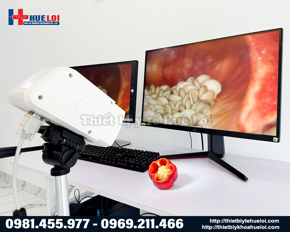 m&aacute;y soi cổ tử cung h&igrave;nh ảnh HD