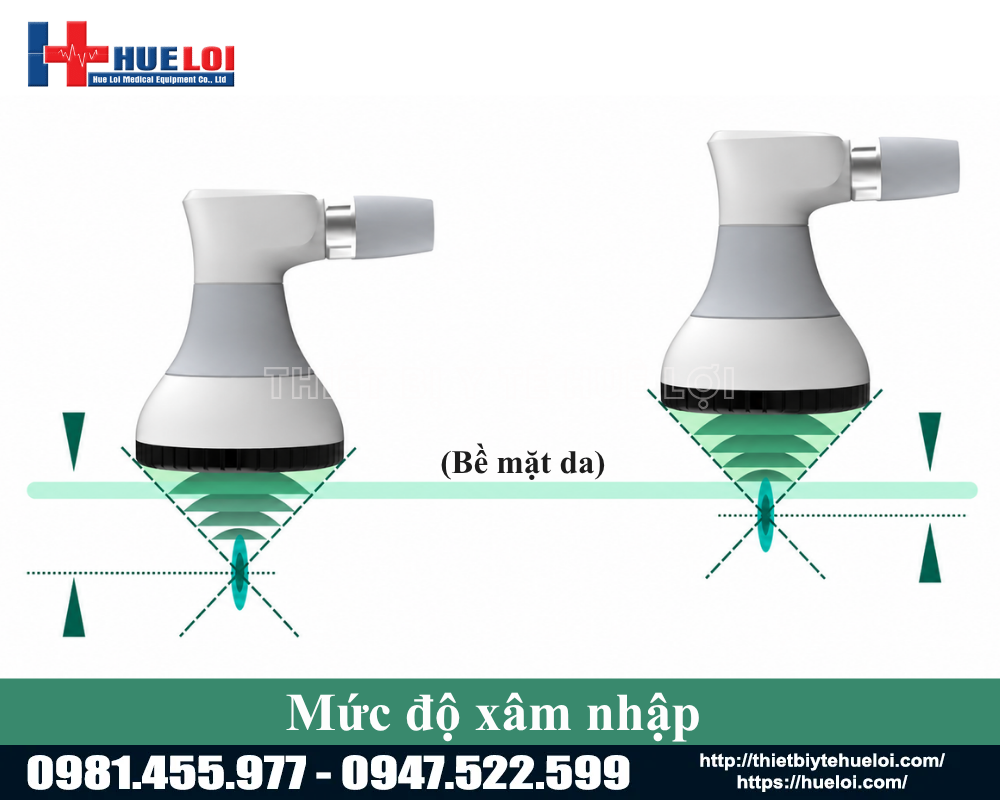 m&aacute;y điều trị s&oacute;ng xung k&iacute;ch &aacute;p điện 