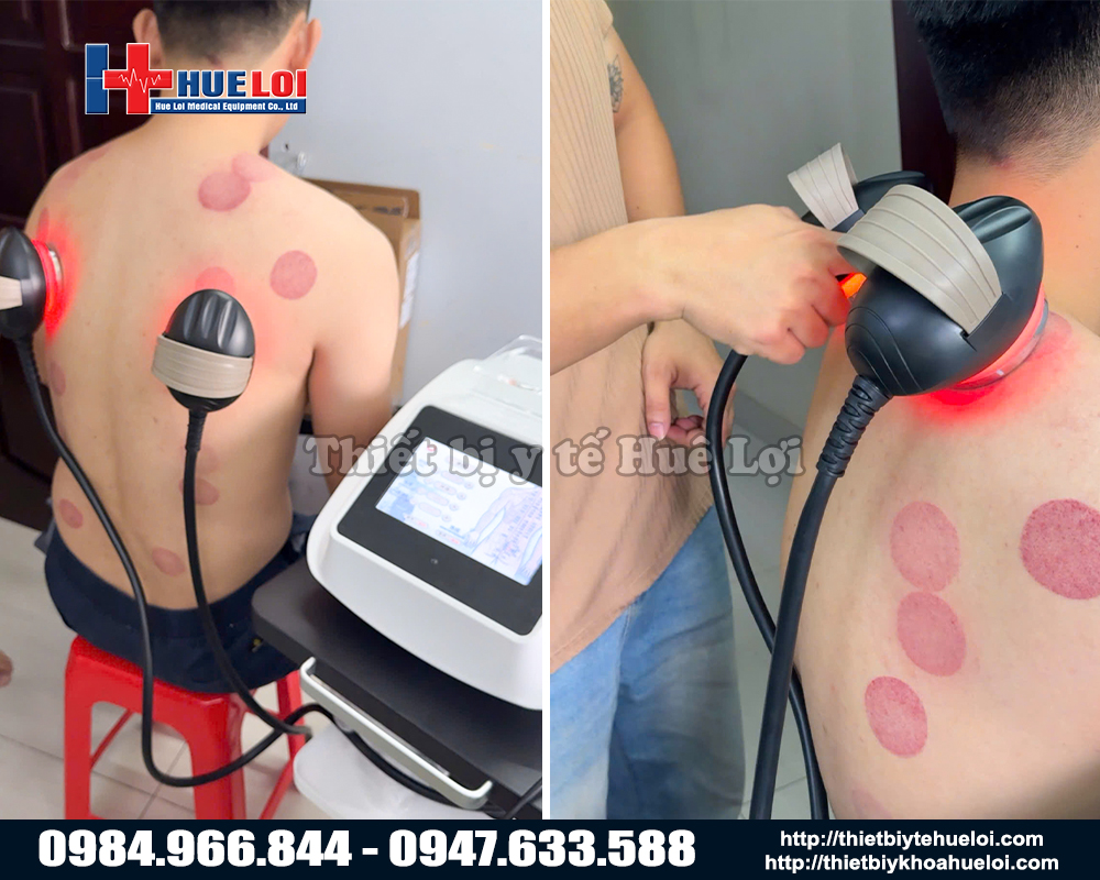 máy điện trị liệu mới nhất thị trường