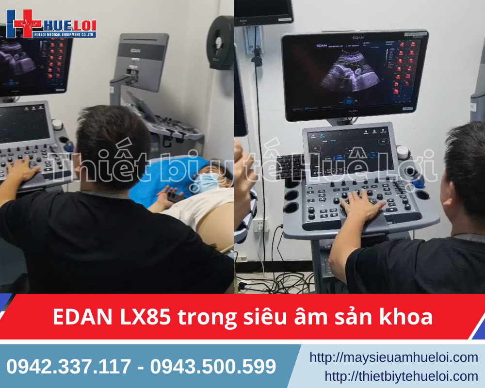 máy siêu âm bàn đẩy giá rẻ