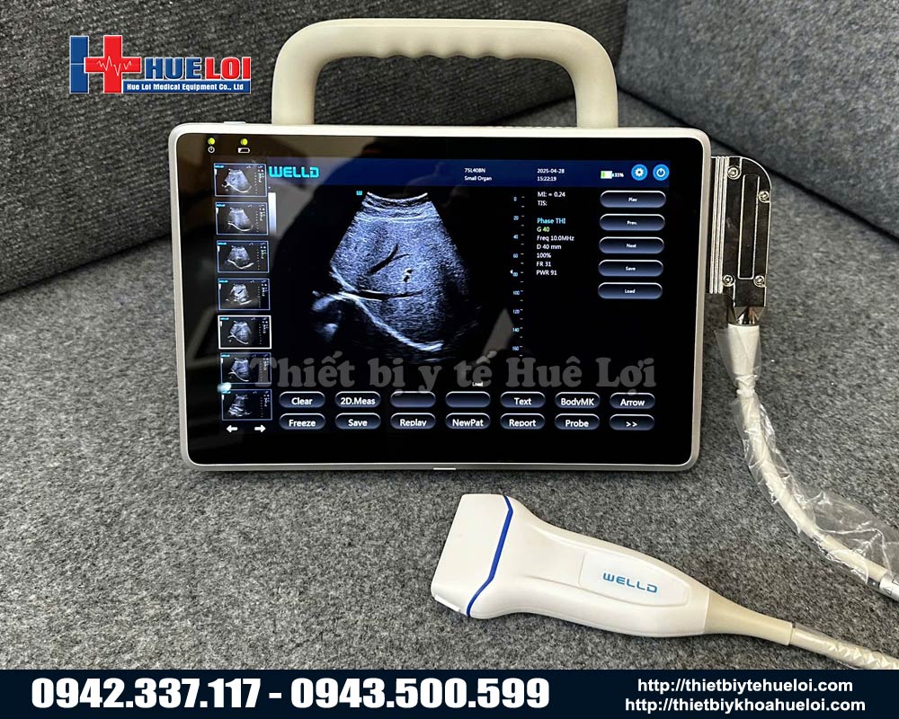 máy siêu âm hình ảnh giá rẻ