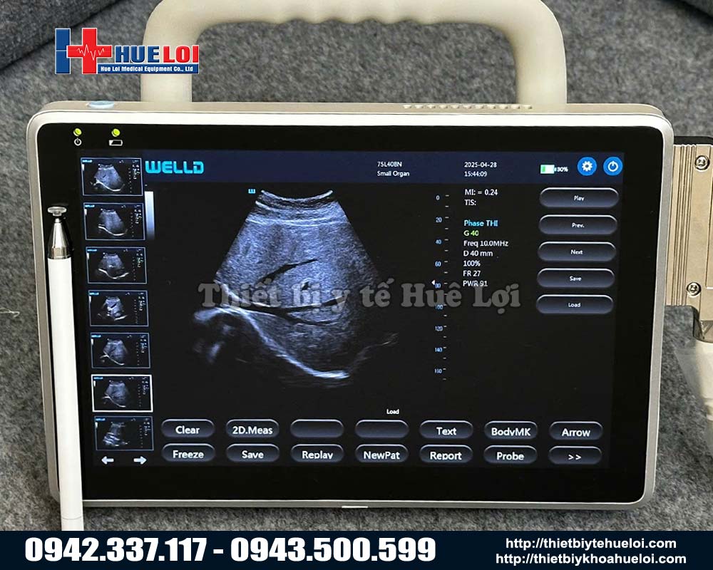 máy siêu âm không dây màn hình cảm ứng