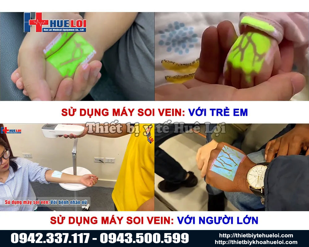 thiết bị soi tĩnh mạch