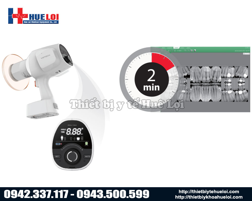 cấu tạo máy x-quang nha khoa di động 
