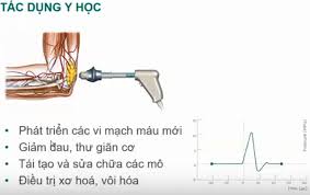 tác dụng sóng xung kích